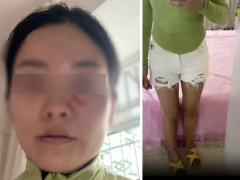 Ảnh bìa bài viết 884565