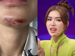 Ảnh bìa bài viết 884523