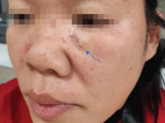 Ảnh bìa bài viết 885120