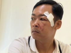 Ảnh bìa bài viết 887624