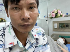Ảnh bìa bài viết 888786