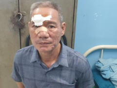 Ảnh bìa bài viết 894238