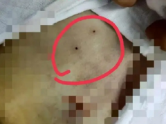 Ảnh bìa bài viết 894705