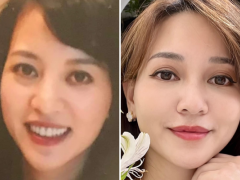 Ảnh bìa bài viết 898473