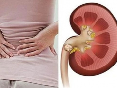 Ảnh bìa bài viết 899826
