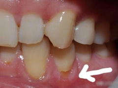 Ảnh bìa bài viết 904792