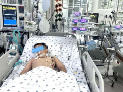 Ảnh bìa bài viết 911492