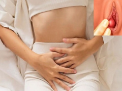 Ảnh bìa bài viết 918296