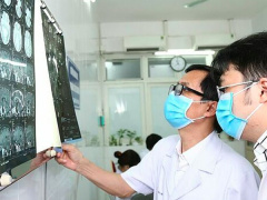 Ảnh bìa bài viết 919906