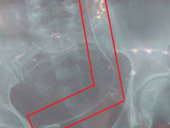 Post cover 923159