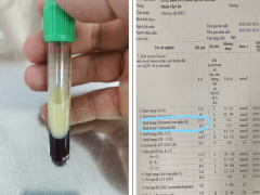 Ảnh bìa bài viết 927645