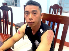 Ảnh bìa bài viết 927768