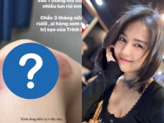 Ảnh bìa bài viết 928312