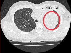 Ảnh bìa bài viết 930702