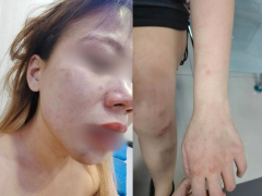 Ảnh bìa bài viết 932119