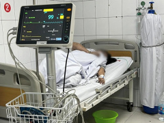 Ảnh bìa bài viết 937886