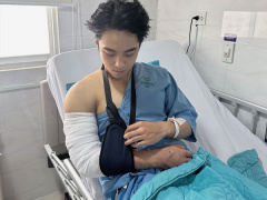 Ảnh bìa bài viết 941548