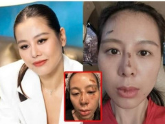 Ảnh bìa bài viết 946185