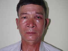 Ảnh bìa bài viết 947759