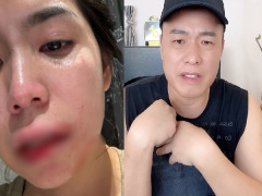 Ảnh bìa bài viết 949950