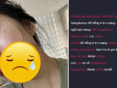 Ảnh bìa bài viết 950632
