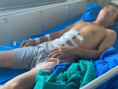 Ảnh bìa bài viết 957258