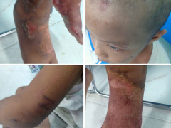 Ảnh bìa bài viết 957874