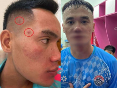Ảnh bìa bài viết 964767