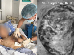 Ảnh bìa bài viết 973618
