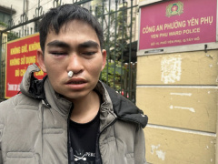 Ảnh bìa bài viết 976434