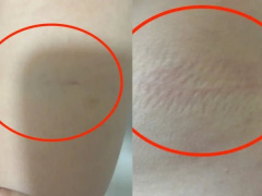 Ảnh bìa bài viết 980344
