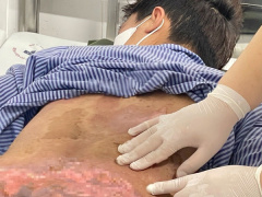 Ảnh bìa bài viết 981596