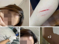 Ảnh bìa bài viết 983191