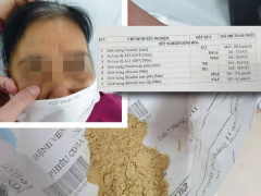 Ảnh bìa bài viết 985651