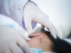 Ảnh bìa bài viết 987764