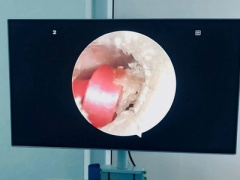 Ảnh bìa bài viết 989853