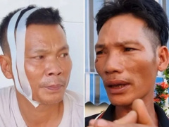 Ảnh bìa bài viết 991911