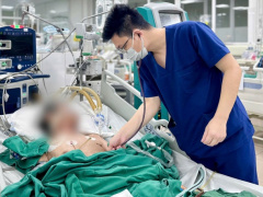 Ảnh bìa bài viết 992556