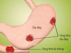 Ảnh bìa bài viết 494623