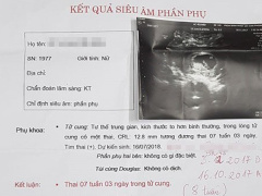 Ảnh bìa bài viết 502813