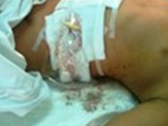 Ảnh bìa bài viết 503296