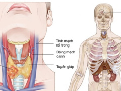 Ảnh bìa bài viết 496100