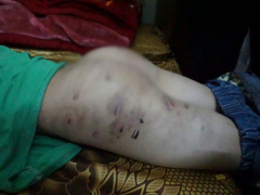 Ảnh bìa bài viết 504580