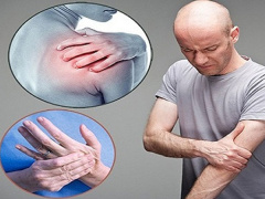 Ảnh bìa bài viết 506087