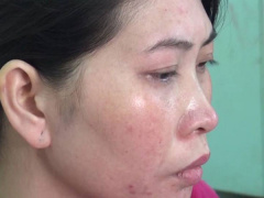 Ảnh bìa bài viết 506310
