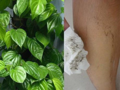 Ảnh bìa bài viết 506483