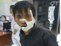Ảnh bìa bài viết 507445