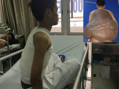 Ảnh bìa bài viết 508612