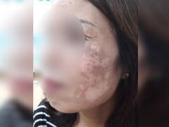 Ảnh bìa bài viết 497644