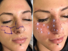 Ảnh bìa bài viết 497867